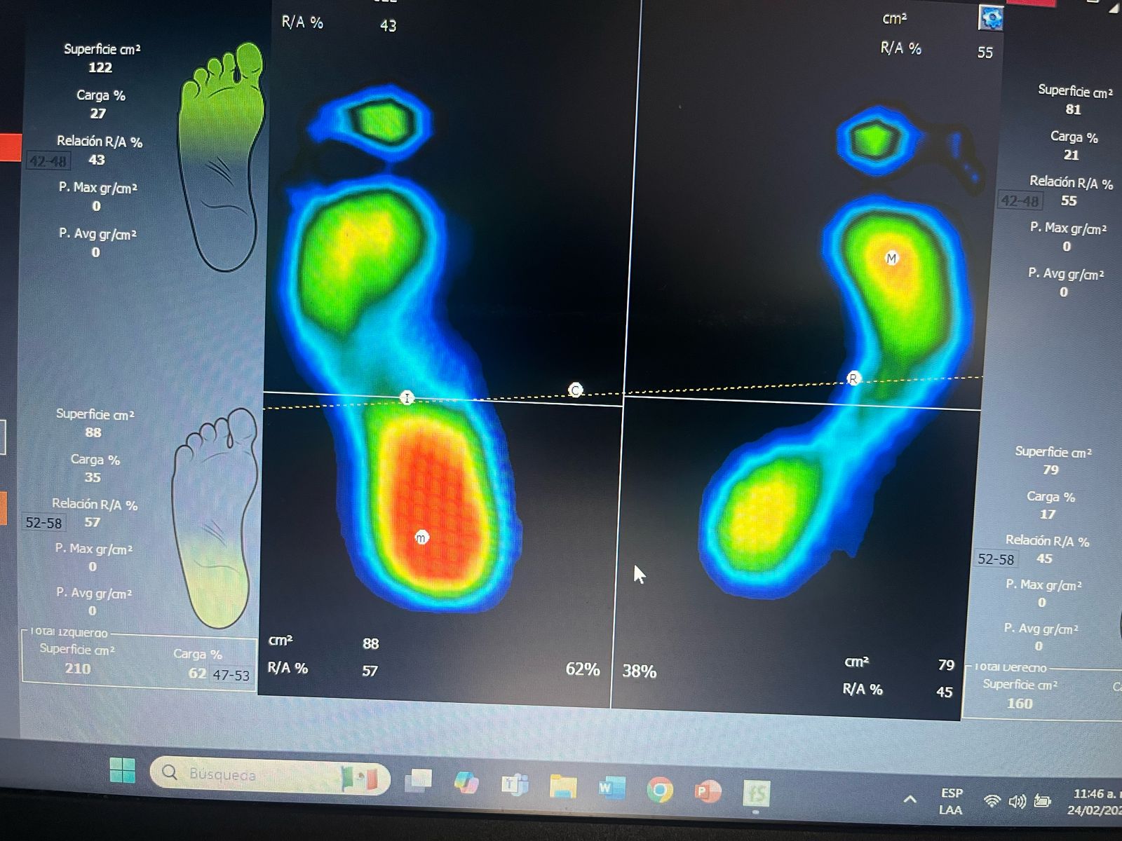 Análisis biomecánico y plantillas personalizadas Lumive